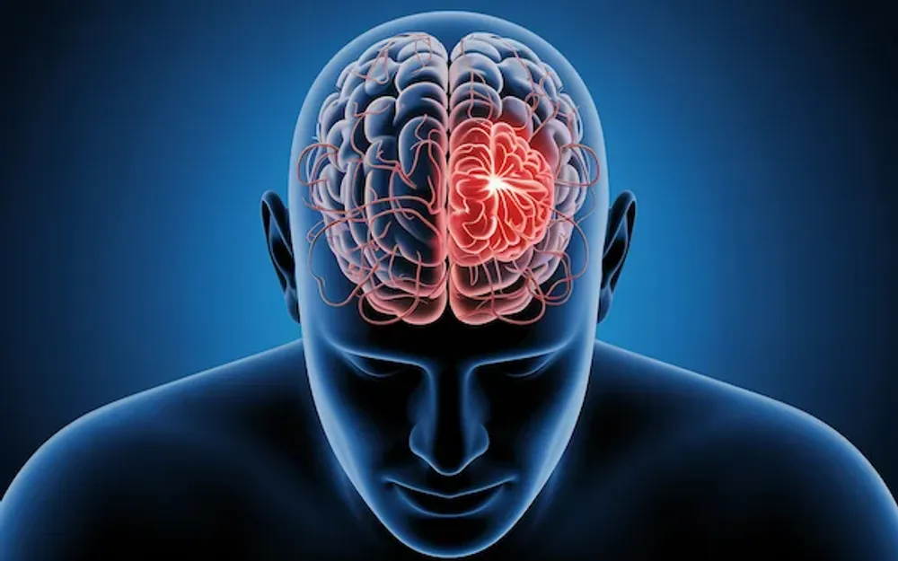 AIIMS-Trained Neurologist Says Stroke Paralysis Can Be Reversed — But There’s a Catch