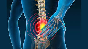 Bone & back problems on rise among ...